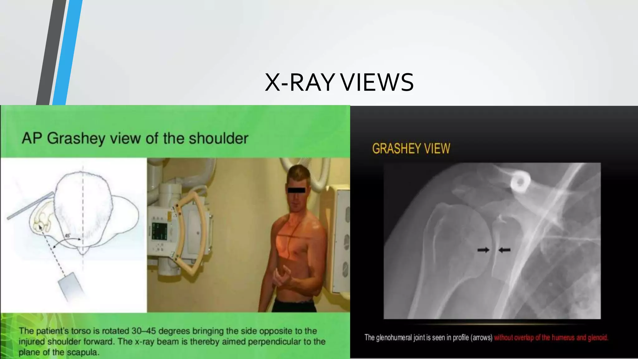 X-RAYVIEWS
 