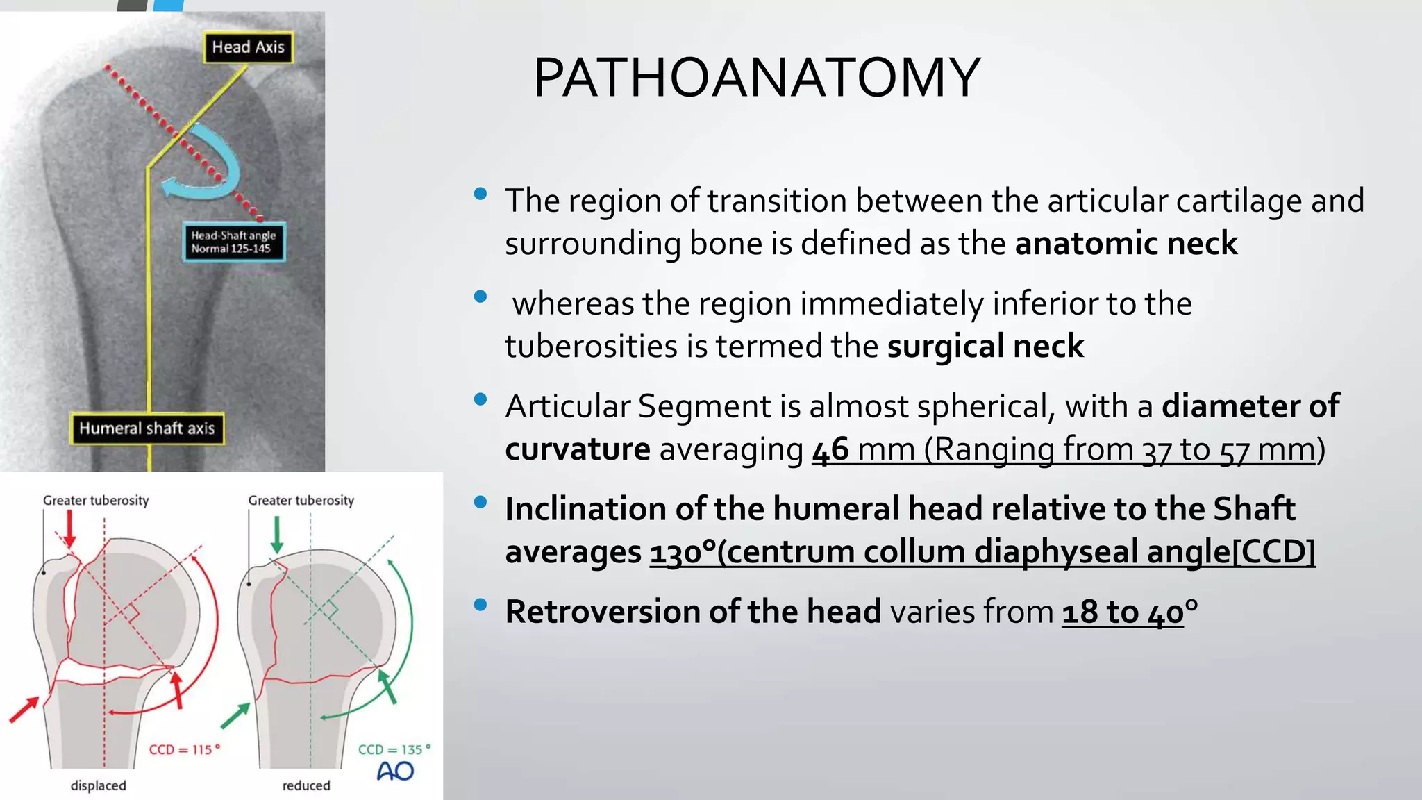 PATHOANATOMY
• The region of transition between the articular cartilage and
surrounding bone is defined as the anatomic neck
• whereas the region immediately inferior to the
tuberosities is termed the surgical neck
• Articular Segment is almost spherical, with a diameter of
curvature averaging 46 mm (Ranging from 37 to 57 mm)
• Inclination of the humeral head relative to the Shaft
averages 130°(centrum collum diaphyseal angle[CCD]
• Retroversion of the head varies from 18 to 40°
 