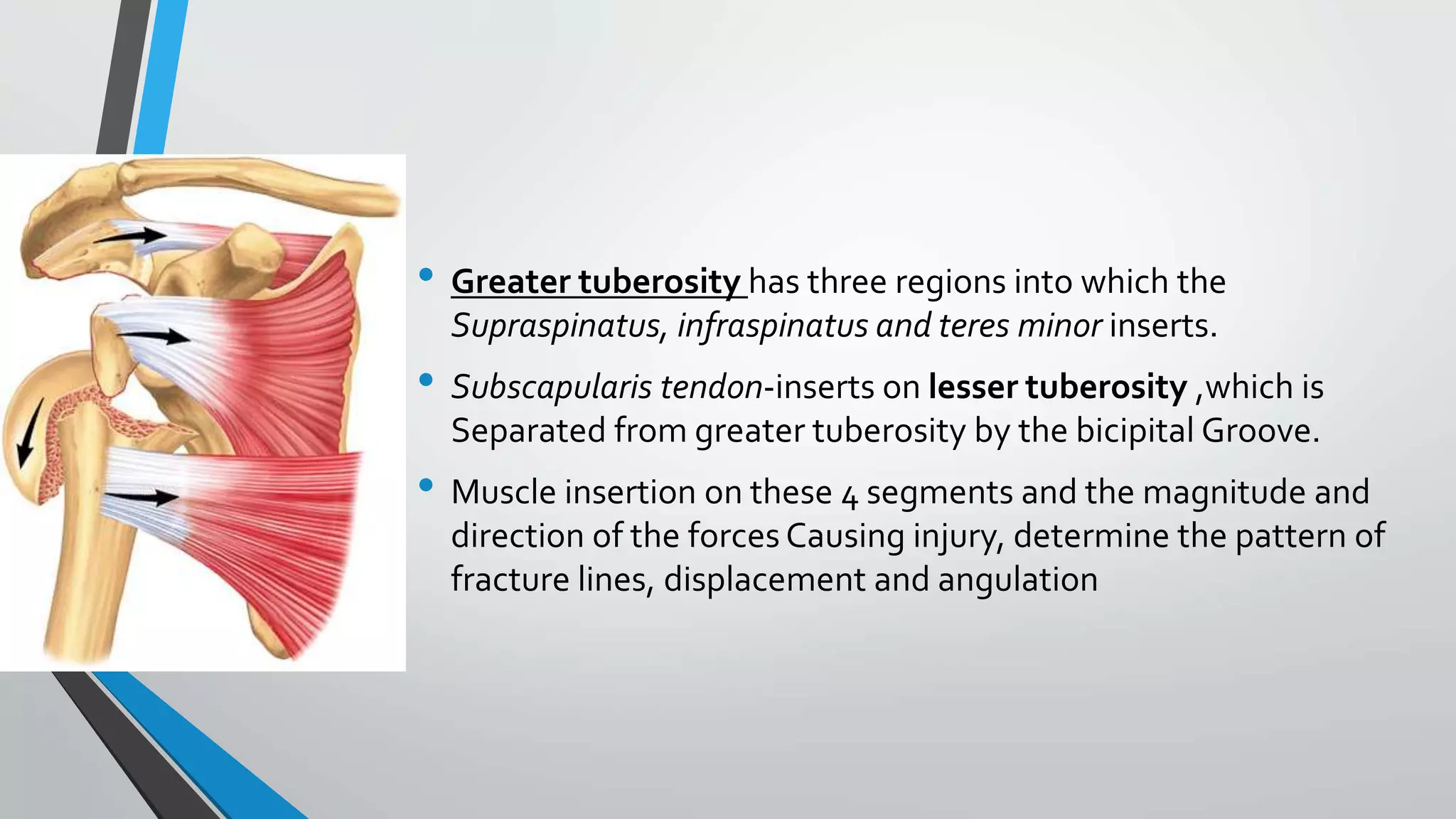 • Greater tuberosity has three regions into which the
Supraspinatus, infraspinatus and teres minor inserts.
• Subscapularis tendon-inserts on lesser tuberosity ,which is
Separated from greater tuberosity by the bicipital Groove.
• Muscle insertion on these 4 segments and the magnitude and
direction of the forces Causing injury, determine the pattern of
fracture lines, displacement and angulation
 