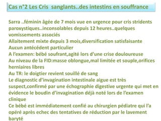 Cas n°2 Les Cris sanglants..des intestins en souffrance
Sarra ..féminin âgée de 7 mois vue en urgence pour cris stridents
paroxystiques..inconsolables depuis 12 heures..quelques
vomissements associés
Allaitement mixte depuis 3 mois,diversification satisfaisante
Aucun antécédent particulier
A l’examen: bébé soufrant,agité lors d’une crise douloureuse
Au niveau de la FID:masse oblongue,mal limitée et souple,orifices
herniaires libres
Au TR: le doigtier revient souillé de sang
Le diagnostic d’invagination intestinale aigue est très
suspect,confirmé par une échographie digestive urgente qui met en
évidence le boudin d’invagination déjà noté lors de l’examen
clinique
Ce bébé est immédiatement confié au chirurgien pédiatre qui l’a
opéré après echec des tentatives de réduction par le lavement
baryté
 