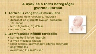 1. Torticollis congetinus muscularis –
fejbiccentő izom rövidülése, feszülése
• duzzanat az újszülött nyakán, fájdalom
• 10. napon
• ferde fejtartás, fej dőlése
• arc asszimetria
2. Izomfeszülés nélküli torticollis
• korrigálható ferde fejtartás
• a nyak mozgása szabad
• rossz szokás, szemtengely eltérés okozhatja
• nagyotthallás
• óvodáskor, kisiskolás kor
A nyak és a törzs betegségei
gyermekkorban
 