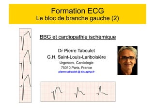 Formation ECG 
Le bloc de branche gauche (2) 
BBG et cardiopathie ischémique 
Dr Pierre Taboulet 
G.H. Saint-Louis-Lariboisière 
Urgences, Cardiologie 
75010 Paris, France 
pierre.taboulet @ sls.aphp.fr 
 
