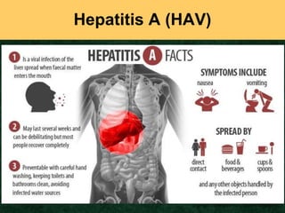 Hepatitis A (HAV)
Copyright Progressive Business Publications
 
