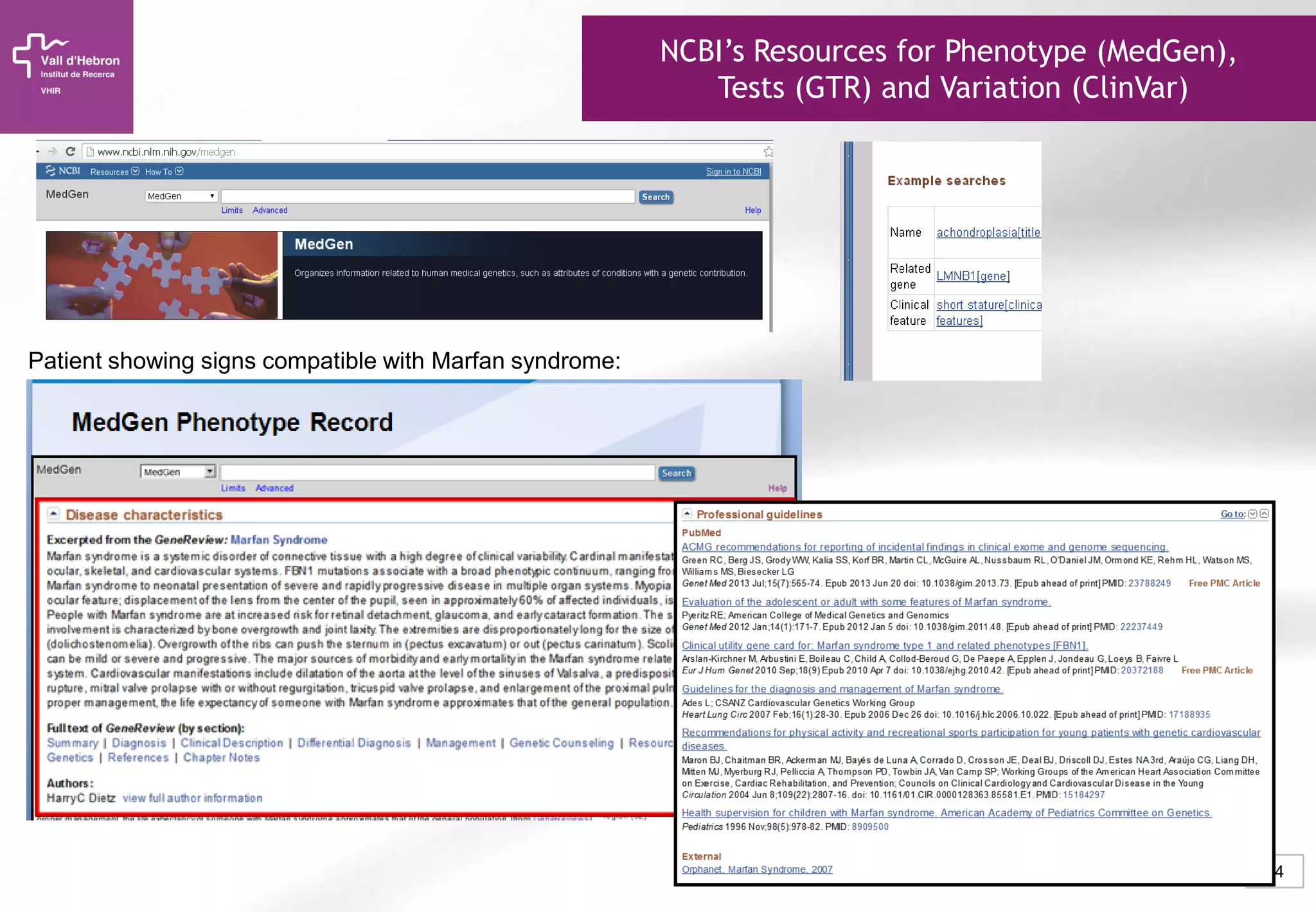 24
NCBI’s Resources for Phenotype (MedGen),
Tests (GTR) and Variation (ClinVar)
Patient showing signs compatible with Marfan syndrome:
 