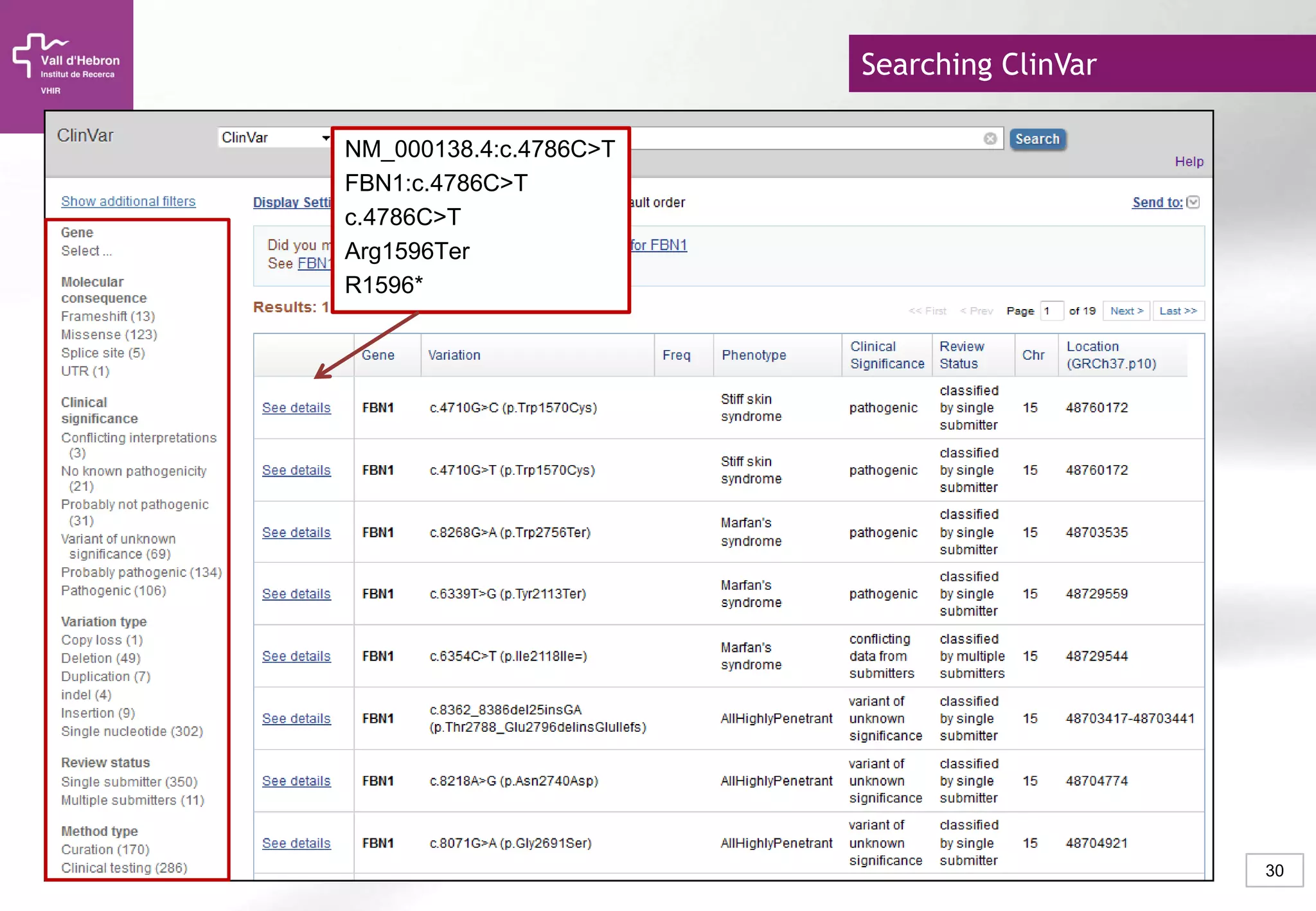 30
Searching ClinVar
NM_000138.4:c.4786C>T
FBN1:c.4786C>T
c.4786C>T
Arg1596Ter
R1596*
 
