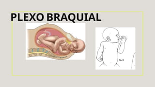 PLEXO BRAQUIAL
 