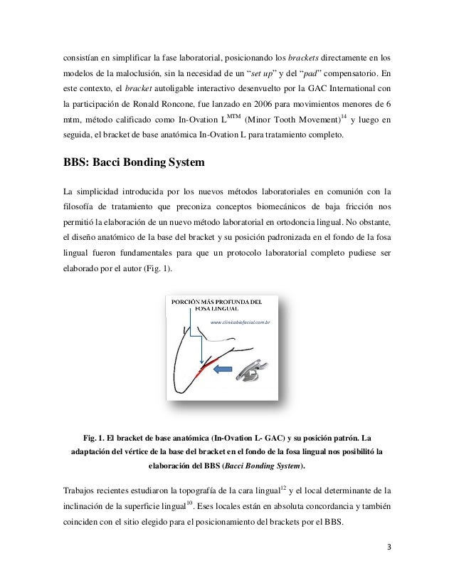 Bbs trading system
