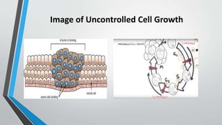 Image of Uncontrolled Cell Growth
 