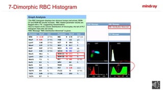 Dimorphic Rbc Graph Sysmex BC-5000&BC-5150 case study 20201123.pptx