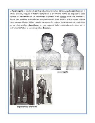 La Acromegalia es ocasionada por la producción anormal de hormona del crecimiento en el
adulto, es decir, después de haberse completado el crecimiento normal del esqueleto y otros
órganos. Se caracteriza por un crecimiento exagerado de los huesos de la cara, mandíbula,
manos, pies y cráneo, y también por un agrandamiento de las vísceras y otros tejidos blandos
como: tiroides, hígado, riñón y corazón. La producción excesiva de la hormona del crecimiento
en los niños produce Gigantismo, lo

que ocasiona tallas exageradamente altas, por el

contrario el déficit de la hormona produce Enanismo.

Acromegalia

Gigantismo y enanismo

 