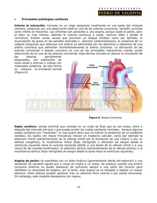 Principales patologías cardíacas
Infarto al miocardio: Consiste en un riego sanguíneo insuficiente en una parte del músculo
cardiaco, producido por una obstrucción total en una de las arterias coronarias, también conocido
como infarto al miocardio. Los síntomas son parecidos a una angina, porque duele el pecho, pero
el dolor es más intenso. Además la víctima comienza a sudar, sentirse débil y perder la
conciencia. Existen varias causas que provocan un ataque cardíaco como por ejemplo, la
acumulación de grasa en las paredes arteriales o ateroma (arteriosclerosis), la presencia de un
coágulo sanguíneo que obstruye una arteria ya estrechada por los ateromas o espasmos de una
arteria coronaria que estrechan momentáneamente la arteria coronaria. La derivación de las
arterias coronarias o bypass coronario es una de las principales indicaciones cuando existe
obstrucción de en una de las arterias coronarias. Esta técnica consiste en desviar la circulación de
las
arterias
parcialmente
bloqueadas, con segmentos de
otras venas o arterias o incluso con
materiales sintéticos, de esta forma
se restaura la circulación normal
(Figura 6).

Figura 6. Bypass Coronario.

Soplo cardíaco: sonido anormal que consiste en un ruido de flujo que se oye antes, entre o
después del intervalo lub-dub o que puede ocultar los ruidos cardíacos normales. Aunque algunos
soplos cardíacos son “inocentes”, lo cual quiere decir que no indican la existencia de un problema
cardíaco, los soplos con mayor frecuencia indican un trastorno valvular, como por ejemplo la
estenosis mitral (estrechamiento de la válvula mitral por la formación de una cicatriz o por un
defecto congénito), la insuficiencia mitral (flujo retrógrado o retroceso de sangre desde el
ventrículo izquierdo hacia la aurícula izquierda debido a una lesión de la válvula mitral o a una
rotura de las cuerdas tendinosas), la estenosis aórtica (estrechamiento de la válvula aórtica) y la
insuficiencia aórtica (flujo retrógrado de sangre desde la aorta hacia el ventrículo izquierdo).
Angina de pecho: se manifiesta con un dolor torácico (generalmente detrás del esternón) y una
sensación de opresión aguda que a veces se irradia a un brazo. Se produce cuando una arteria
coronaria enferma no puede abastecer de suficiente sangre a una parte del corazón para
satisfacer su necesidad de oxígeno, por lo tanto, este órgano se ve obligado a realizar un mayor
esfuerzo. Estos dolores pueden aparecer tras un esfuerzo físico intenso o por estrés emocional.
Sin embargo, esta molestia desaparece con reposo.

19

 