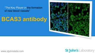 “The Key Player in the formation
of new blood vessels”
www.stjohnslabs.com
BCAS3 antibody
 