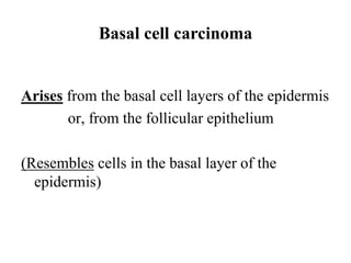 Basal cell carcinoma | PDF