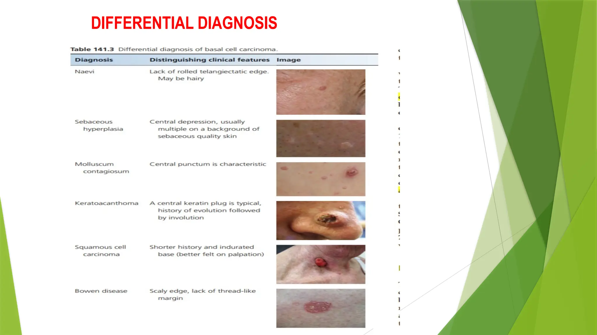 DIFFERENTIAL DIAGNOSIS
 