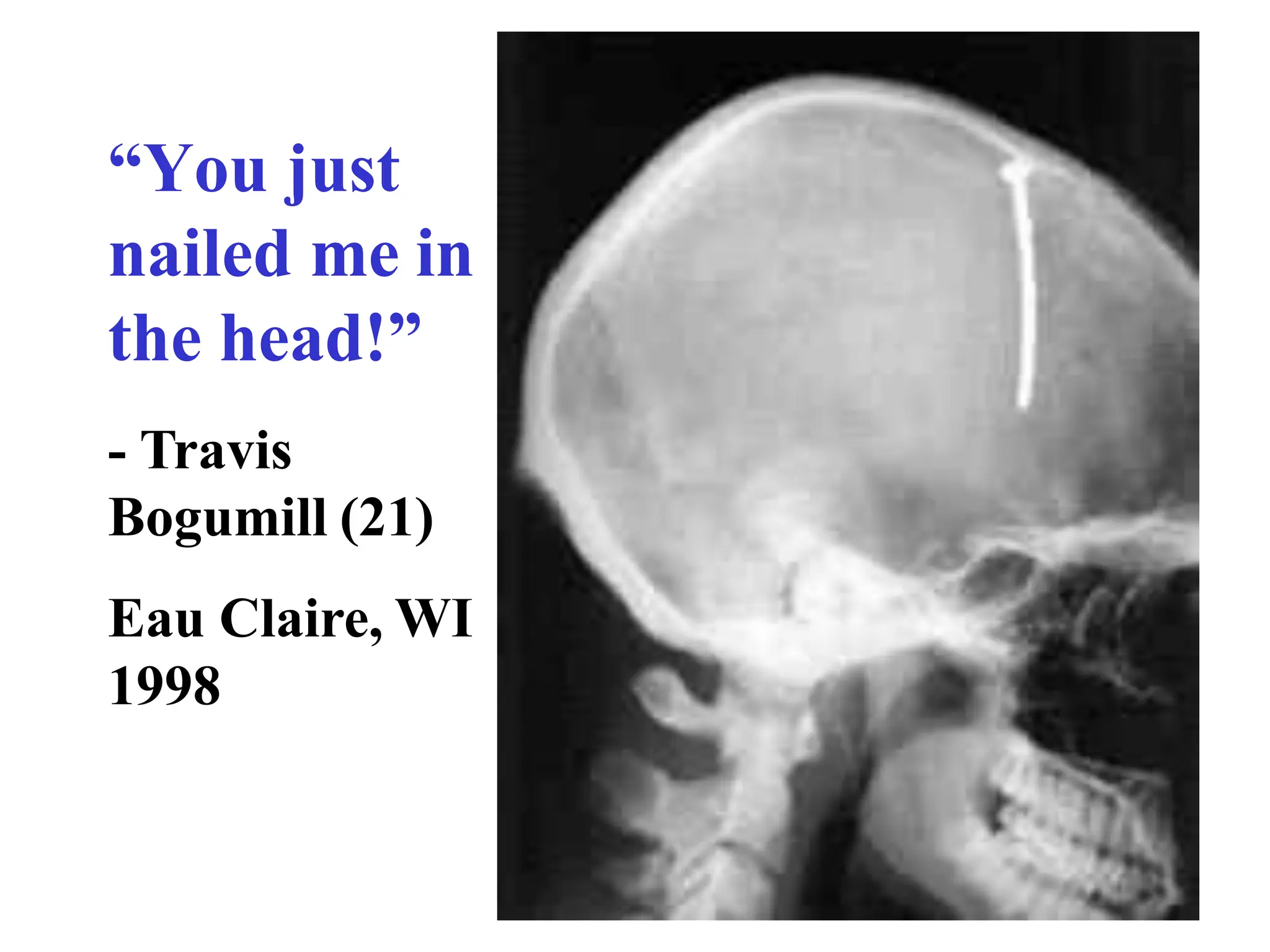 “You just
nailed me in
the head!”
- Travis
Bogumill (21)
Eau Claire, WI
1998
 