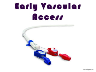 Early Vascular
Access
http://medgadget.com
 