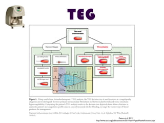 TEG
Patton et al, 2012
http://www.aacc.org/publications/cln/2011/April/Pages/PlateletFunction.aspx
 