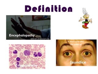 Jaundice
Definition
Encephalopathy
A short time after
the onset of
Coagulopathy
http://www.capitalpath.com.au/about-us/laboratory-information.aspx
http://patient.co.uk
Encephalopathy
 