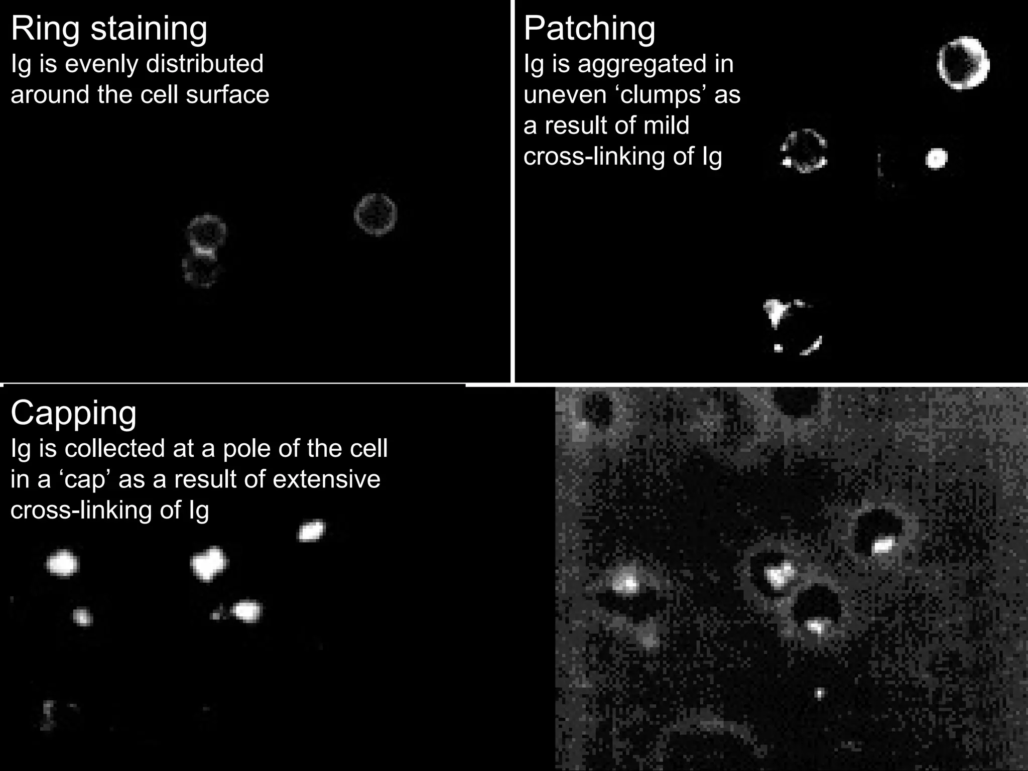 Ring staining Ig is evenly distributed around the cell surface Patching Ig is aggregated in uneven ‘clumps’ as a result of mild cross-linking of Ig Capping Ig is collected at a pole of the cell in a ‘cap’ as a result of extensive cross-linking of Ig 