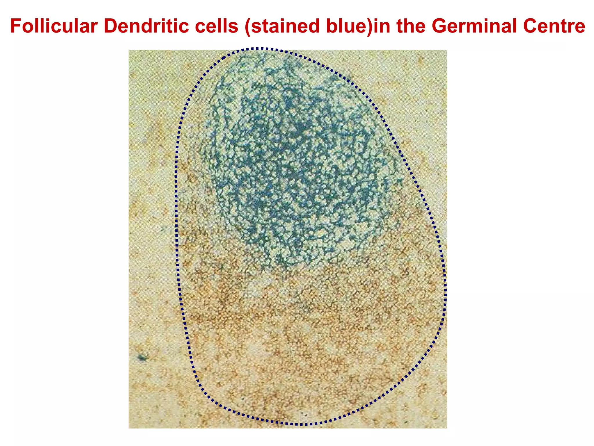 Follicular Dendritic cells (stained blue)in the Germinal Centre 