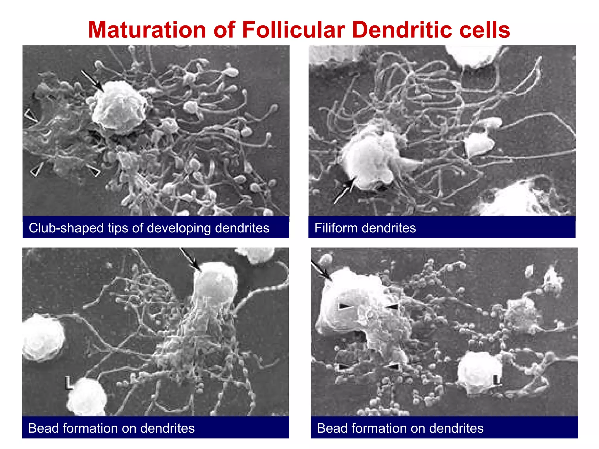 Maturation of Follicular Dendritic cells Club-shaped tips of developing dendrites Filiform dendrites Bead formation on dendrites Bead formation on dendrites 