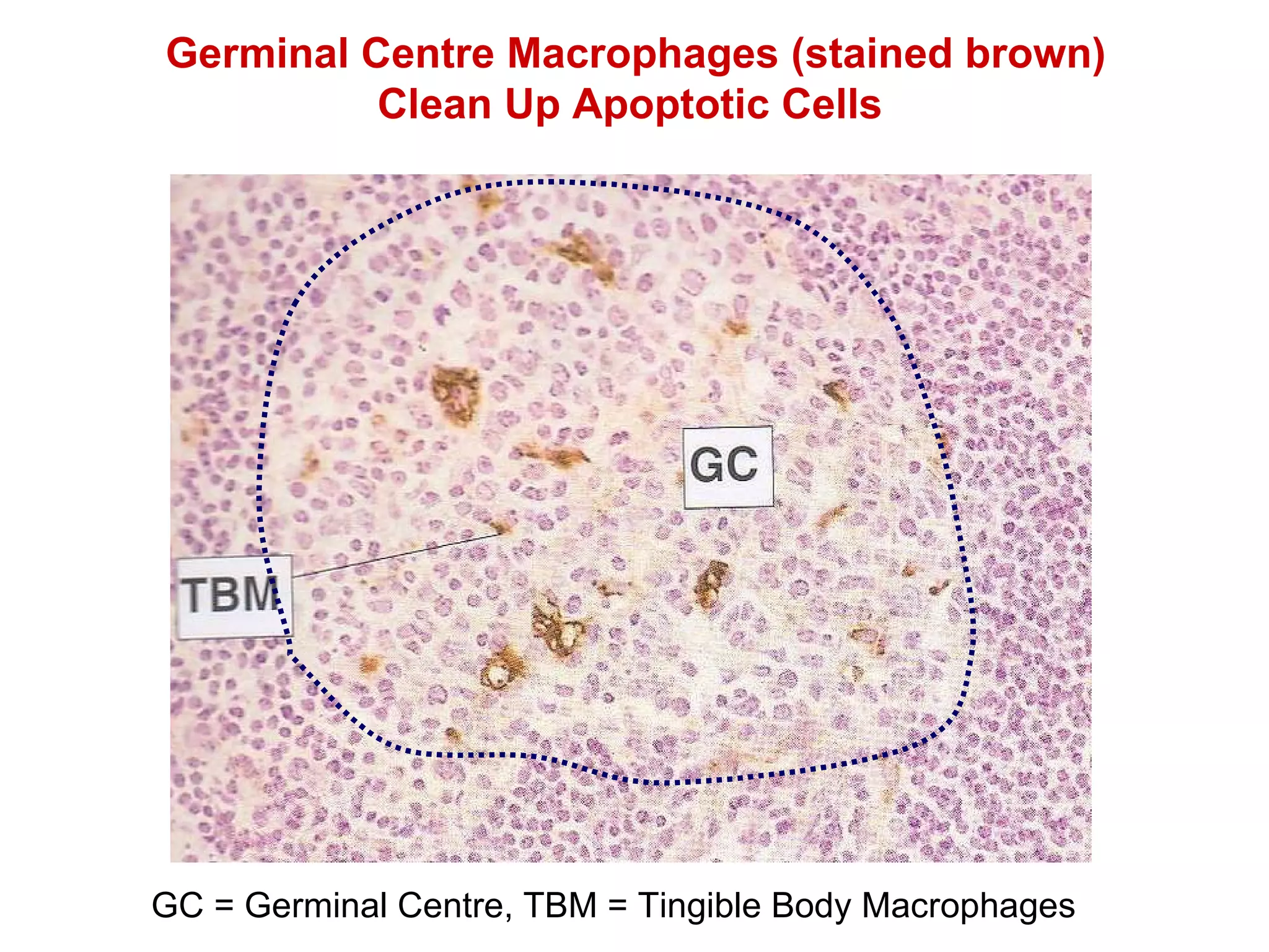 GC = Germinal Centre, TBM = Tingible Body Macrophages Germinal Centre Macrophages (stained brown) Clean Up Apoptotic Cells  