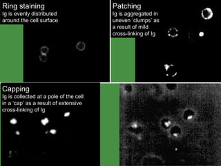 Capping Staining Patterns B Cell Development | PPT