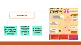 Comprehensive Overview of Tuberculosis and BCG Vaccination | PPTX