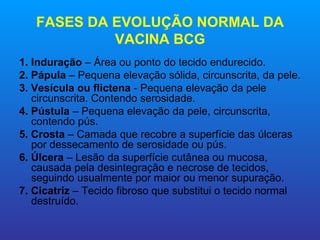 FASES DA EVOLUÇÃO NORMAL DA
            VACINA BCG
1. Induração – Área ou ponto do tecido endurecido.
2. Pápula – Pequena elevação sólida, circunscrita, da pele.
3. Vesícula ou flictena - Pequena elevação da pele
   circunscrita. Contendo serosidade.
4. Pústula – Pequena elevação da pele, circunscrita,
   contendo pús.
5. Crosta – Camada que recobre a superfície das úlceras
   por dessecamento de serosidade ou pús.
6. Úlcera – Lesão da superfície cutânea ou mucosa,
   causada pela desintegração e necrose de tecidos,
   seguindo usualmente por maior ou menor supuração.
7. Cicatriz – Tecido fibroso que substitui o tecido normal
   destruído.
 