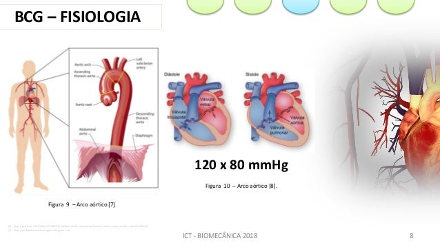 Ballistocardiogram
