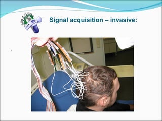 Signal acquisition – invasive: .  