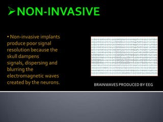 BRAINWAVES PRODUCED BY EEG
• Non-invasive implants
produce poor signal
resolution because the
skull dampens
signals, dispersing and
blurring the
electromagnetic waves
created by the neurons.
 
