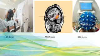 MEG device MEG Process EEG Device
 
