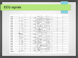EEG signals
 