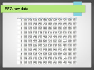 EEG raw data
 