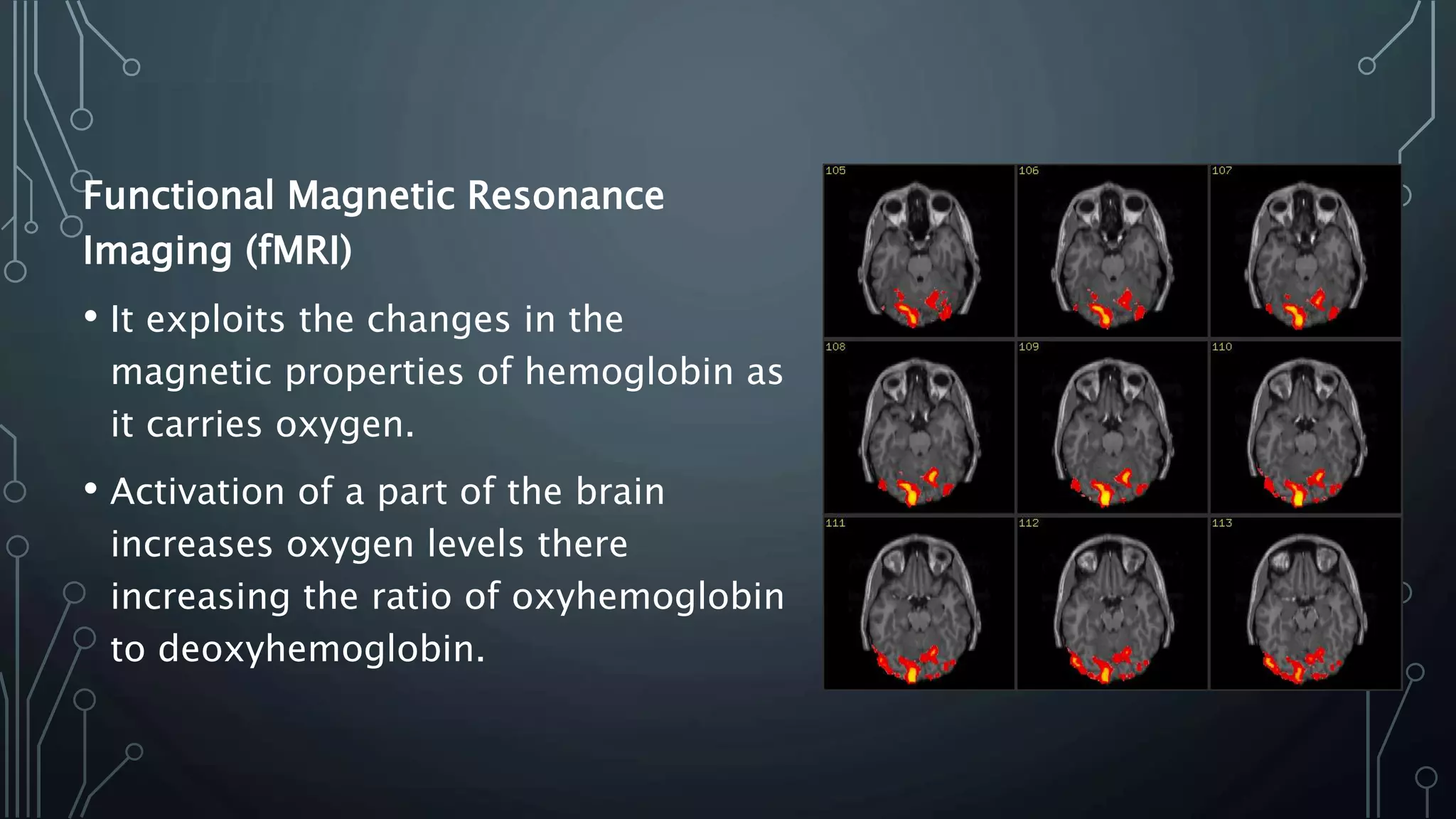 Functional Magnetic Resonance
Imaging (fMRI)
• It exploits the changes in the
magnetic properties of hemoglobin as
it carries oxygen.
• Activation of a part of the brain
increases oxygen levels there
increasing the ratio of oxyhemoglobin
to deoxyhemoglobin.
 