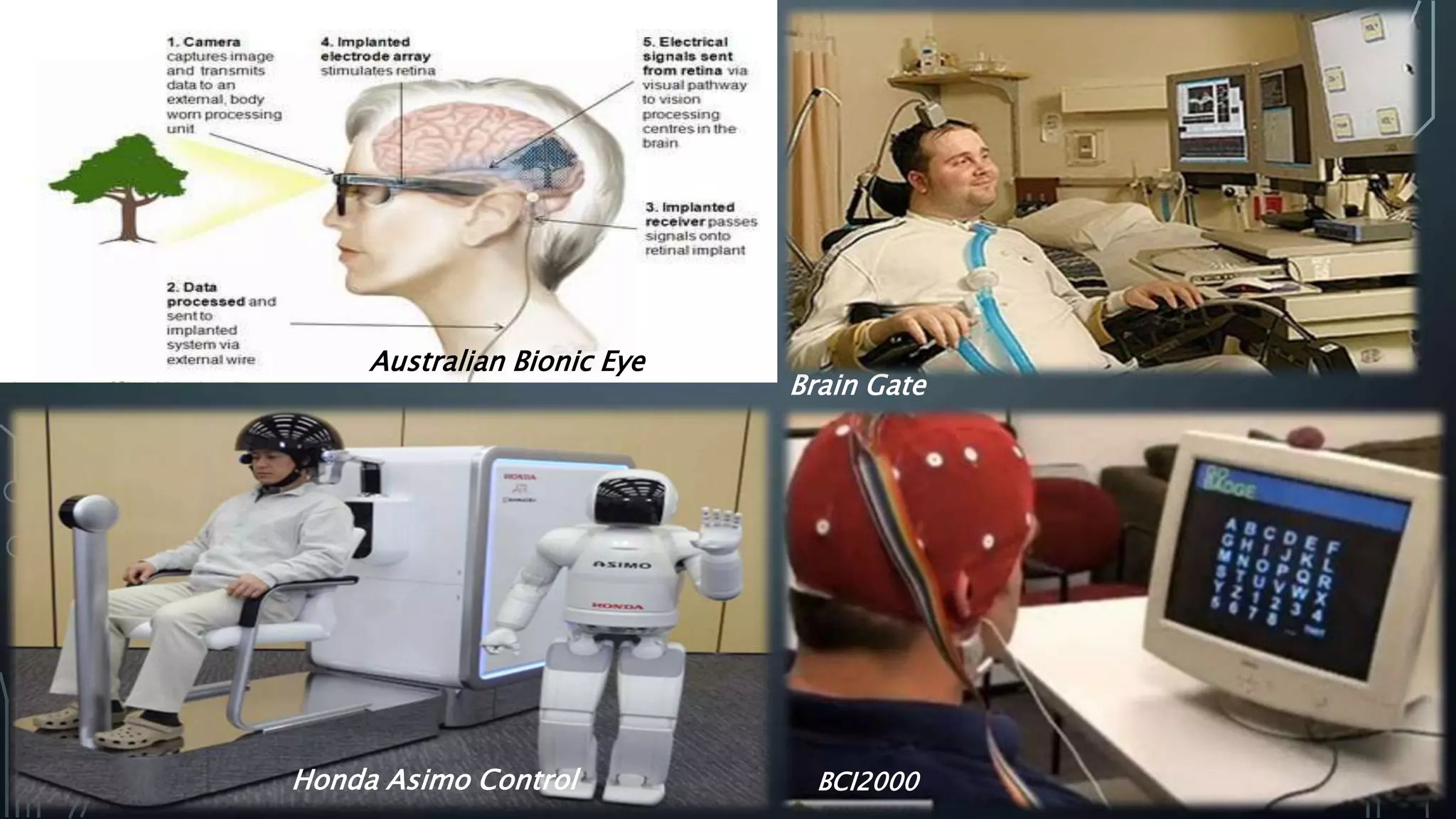 Brain Gate
Australian Bionic Eye
Honda Asimo Control BCI2000
 