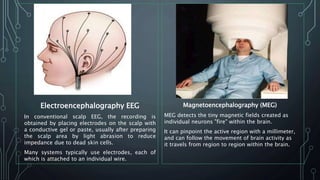 Electroencephalography EEG
In conventional scalp EEG, the recording is
obtained by placing electrodes on the scalp with
a conductive gel or paste, usually after preparing
the scalp area by light abrasion to reduce
impedance due to dead skin cells.
Many systems typically use electrodes, each of
which is attached to an individual wire.
Magnetoencephalography (MEG)
MEG detects the tiny magnetic fields created as
individual neurons "fire" within the brain.
It can pinpoint the active region with a millimeter,
and can follow the movement of brain activity as
it travels from region to region within the brain.
 