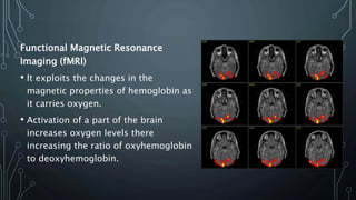 Functional Magnetic Resonance
Imaging (fMRI)
• It exploits the changes in the
magnetic properties of hemoglobin as
it carries oxygen.
• Activation of a part of the brain
increases oxygen levels there
increasing the ratio of oxyhemoglobin
to deoxyhemoglobin.
 