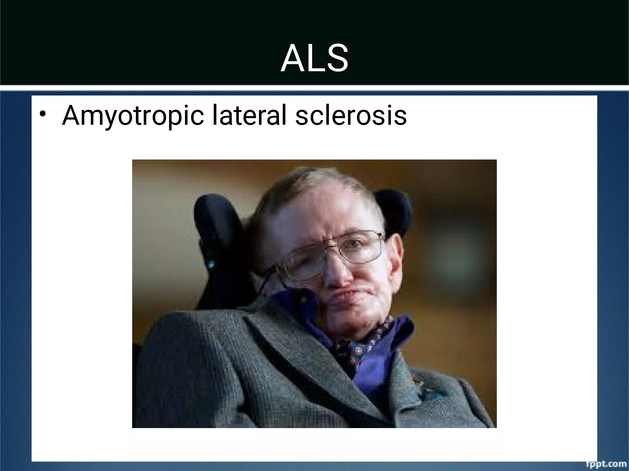 ALS
• Amyotropic lateral sclerosis
 