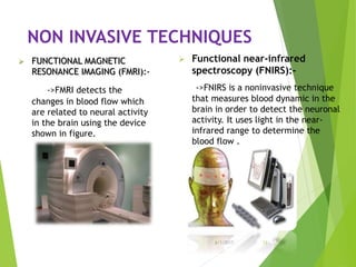 NON INVASIVE TECHNIQUES
 FUNCTIONAL MAGNETIC
RESONANCE IMAGING (FMRI):-
->FMRI detects the
changes in blood flow which
are related to neural activity
in the brain using the device
shown in figure.
6/1/2017 12
 Functional near-infrared
spectroscopy (FNIRS):-
->FNIRS is a noninvasive technique
that measures blood dynamic in the
brain in order to detect the neuronal
activity. It uses light in the near-
infrared range to determine the
blood flow .
 