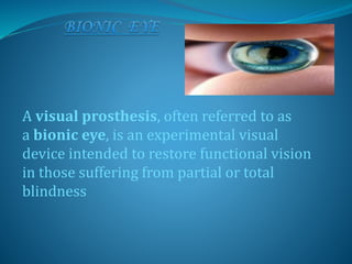 A visual prosthesis, often referred to as
a bionic eye, is an experimental visual
device intended to restore functional vision
in those suffering from partial or total
blindness
 