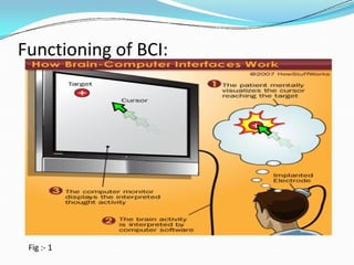 Functioning of BCI:
Fig :- 1
 