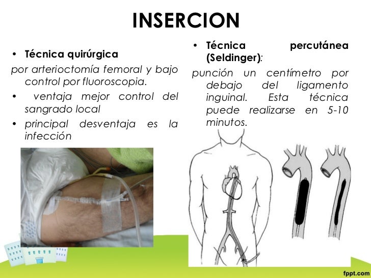Tecnica debajo de la falda 9