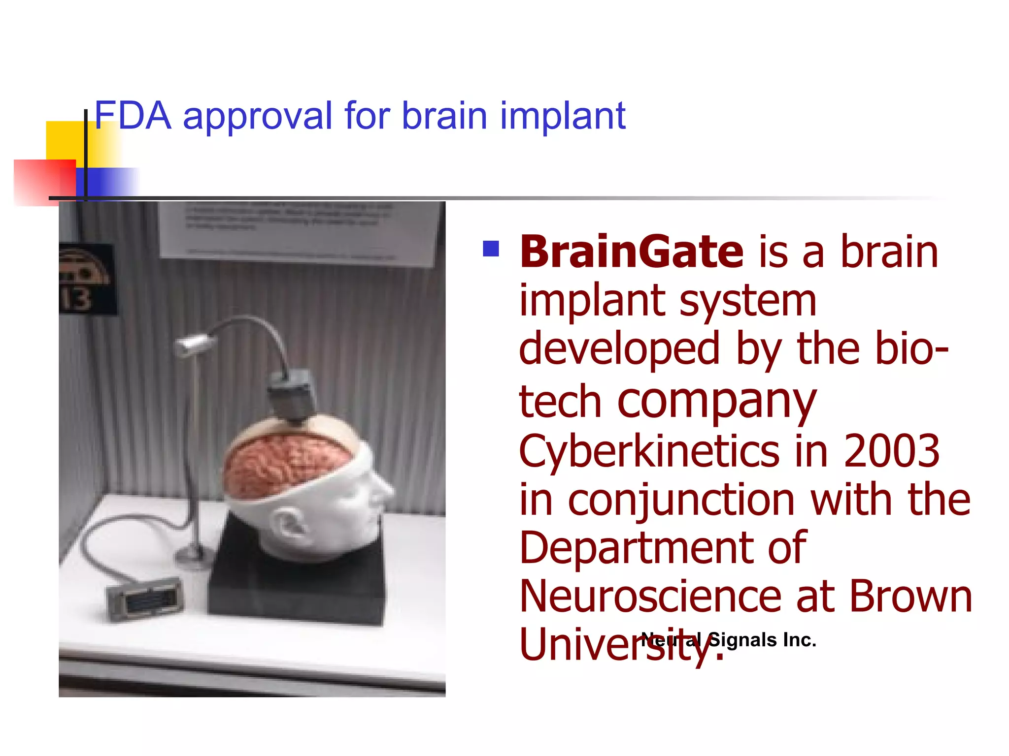 BrainGate  is a brain implant system developed by the bio-tech  company  Cyberkinetics in 2003 in conjunction with the Department of Neuroscience at Brown University.   FDA approval for brain implant Cyberkinetics Inc. Neural Signals Inc. 