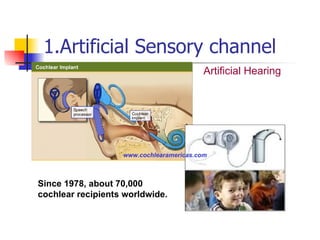 1.Artificial Sensory channel Artificial Hearing Since 1978, about 70,000 cochlear recipients worldwide. www.cochlearamericas.com 