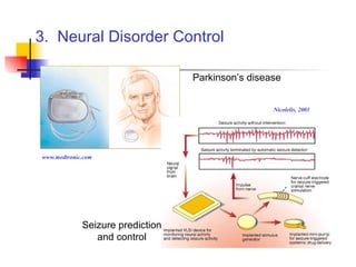 3.  Neural Disorder Control Parkinson’s disease Seizure prediction and control Nicolelis, 2001 www.medtronic.com 