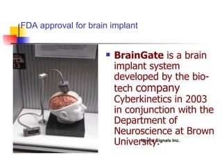 BrainGate  is a brain implant system developed by the bio-tech  company  Cyberkinetics in 2003 in conjunction with the Department of Neuroscience at Brown University.   FDA approval for brain implant Cyberkinetics Inc. Neural Signals Inc. 