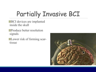 BCI(Brain Computer Interface) project | PPT