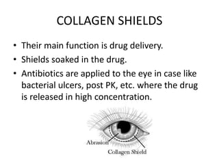 COLLAGEN SHIELDS
• Their main function is drug delivery.
• Shields soaked in the drug.
• Antibiotics are applied to the eye in case like
bacterial ulcers, post PK, etc. where the drug
is released in high concentration.
 